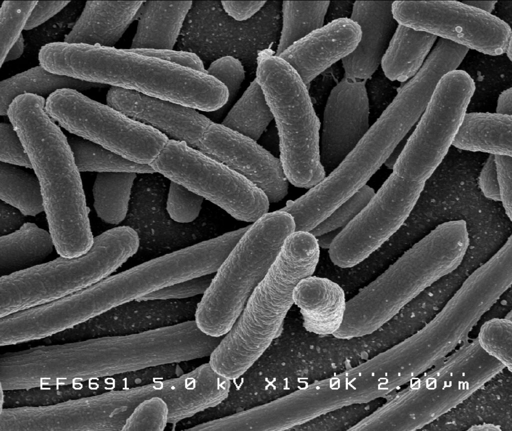 Eesti Vee-ettevõtete Liidu palvel hajutab teadmatusepilvi kolibakteri ja coli-laadsete bakterite kohalt Tartu Ülikooli meditsiinilise mikroobiökoloogia professo
