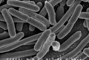 Credit:Ê Rocky Mountain Laboratories, NIAID, NIH Ê Scanning electron micrograph of Escherichia coli, grown in culture and adhered to a coverslip